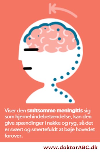 Meningitis - forstå det på fem minutter